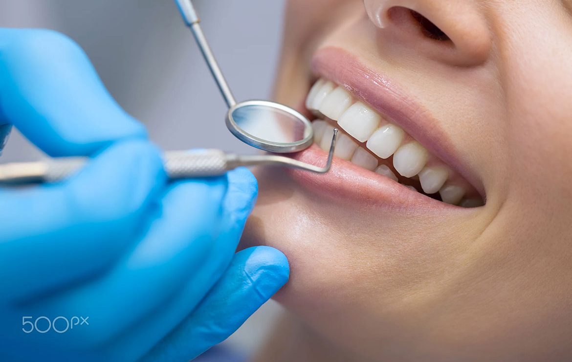 Alimentos surpreendentes que são realmente bons para os dentes