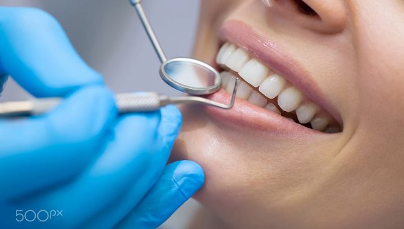 Alimentos surpreendentes que são realmente bons para os dentes