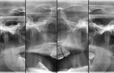 Radiografia de ATM