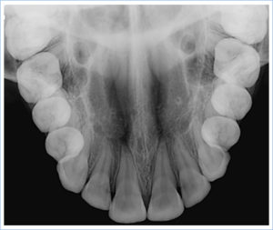 oclusal-2-300x253