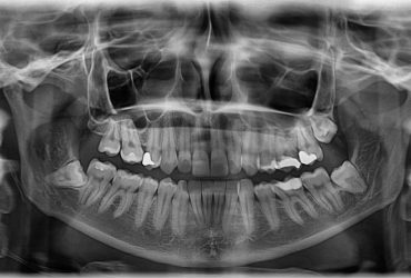 Radiografia Panorâmica