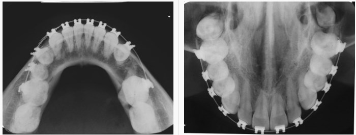 oclusal-700x265